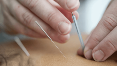 Acupuncture Services for Natural Healing and Pain Relief