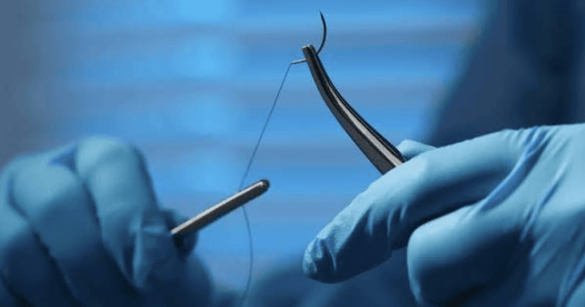 Surgical Suture Hooks: Design Considerations for Modern Medical Instruments